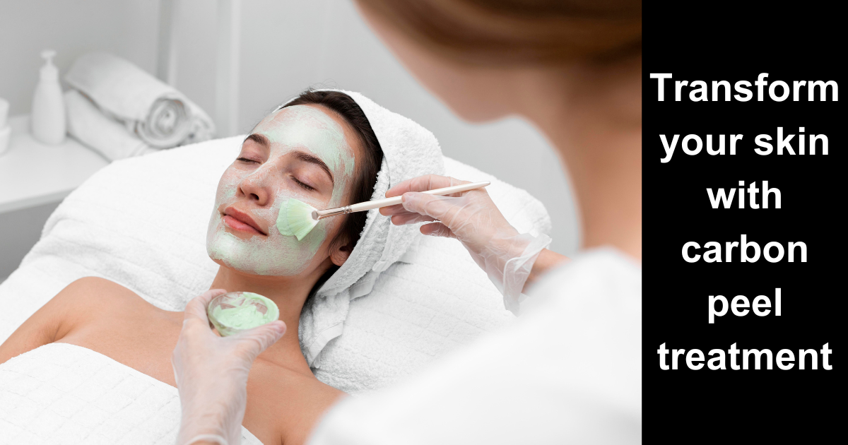 Acne Scars, Be Gone: Transform Your Skin with Carbon Peel Treatment