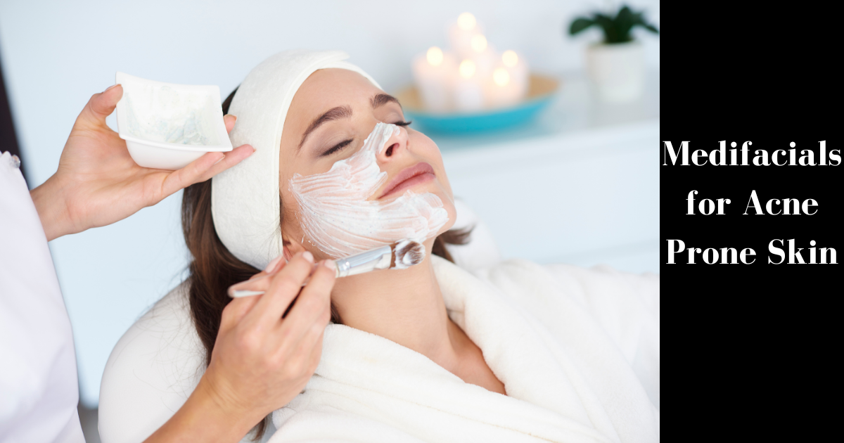 Medifacials for Acne Prone Skin: Myth or Miracle