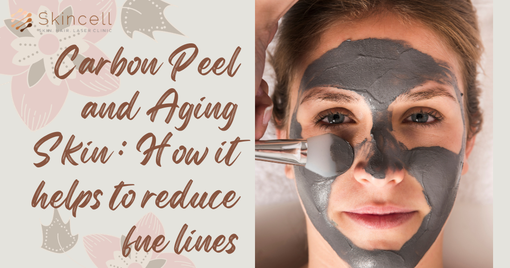 Carbon Peel and Aging Skin: How it helps to reduce fine lines.