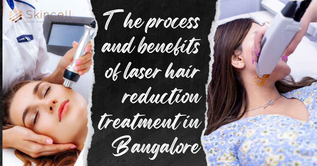 laser hair reduction treatment in Bangalore