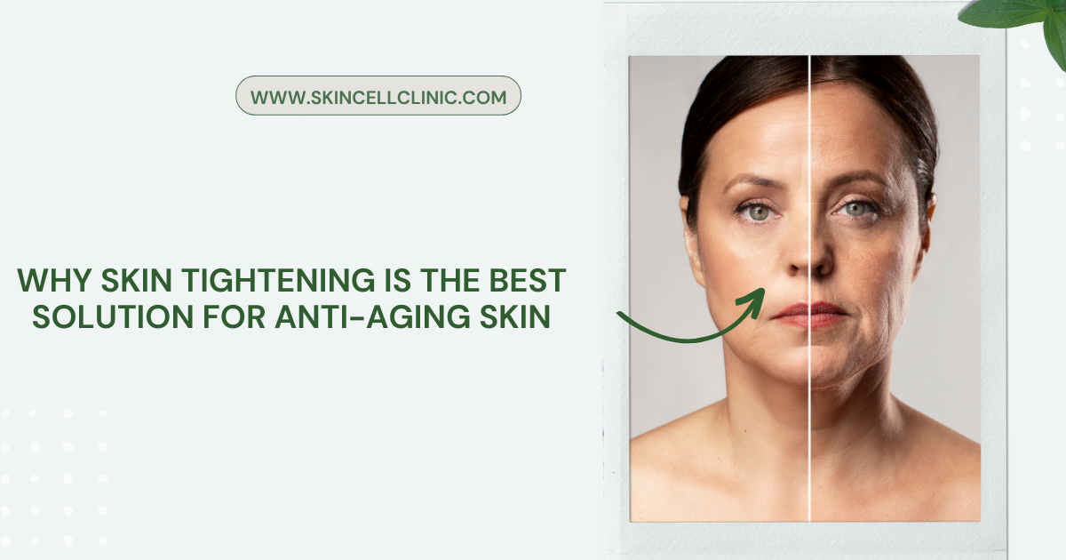Why skin tightening is the best solution for anti-aging skin