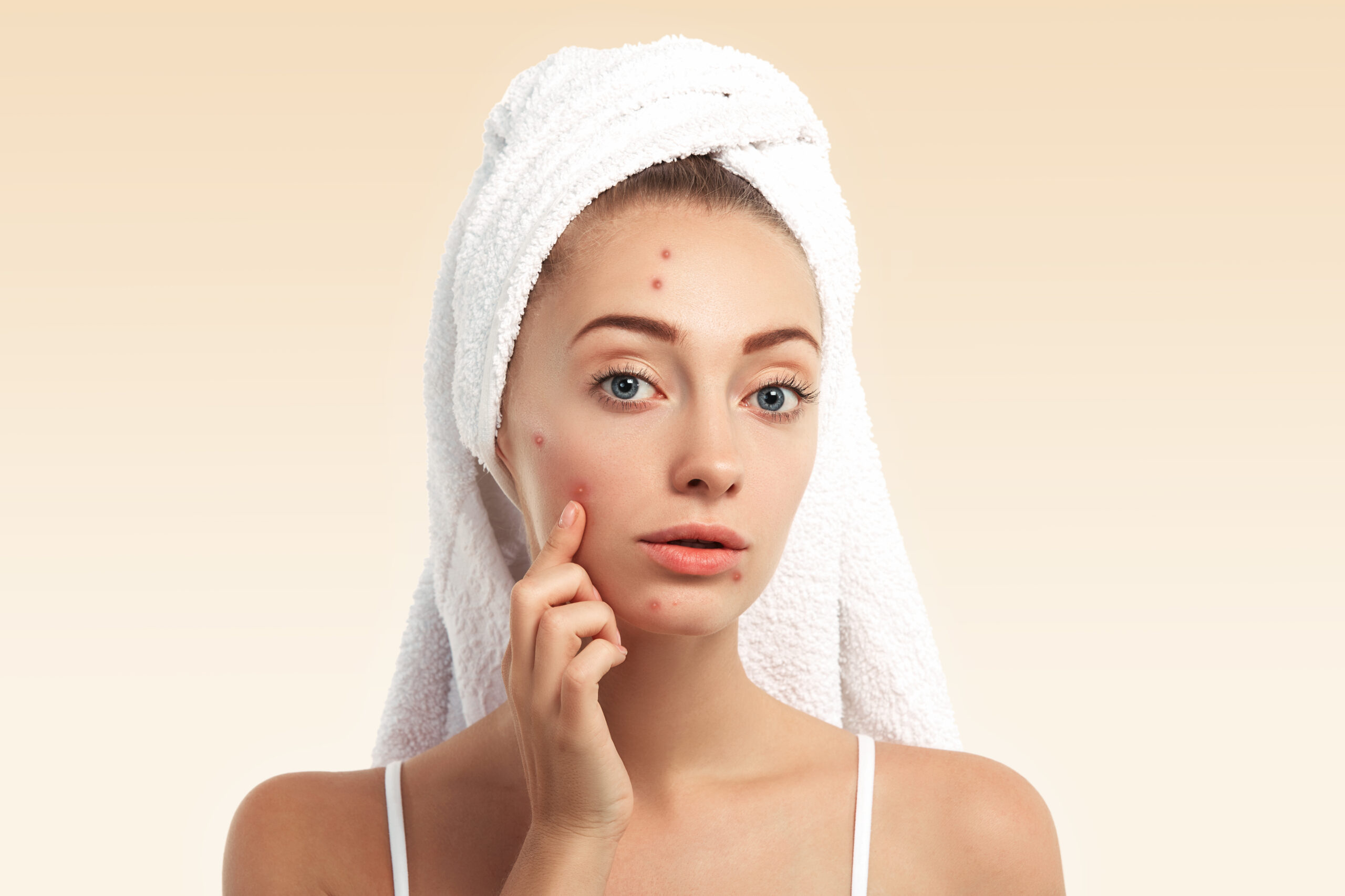 Close up isolated portrait of beautiful young Caucasian woman with blue eyes and problem skin, looking at the camera, pointing at pimple wearing white towel on her head against blue studio background