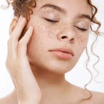 HYPERPIGMENTATION HYPERPIGMENTATION