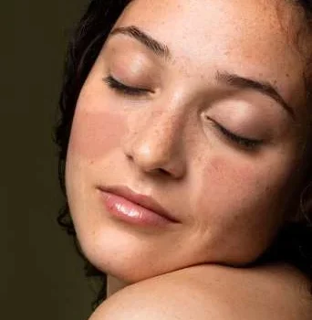 MELASMA 1