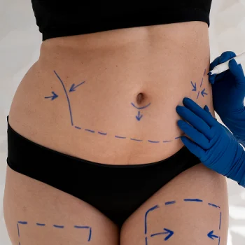 Weight Loss Treatment Weight Loss Treatment